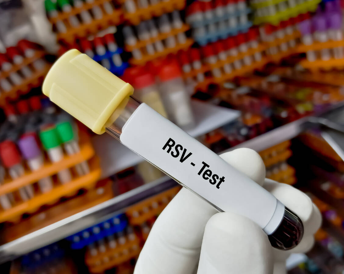 RSV gehört wie SARS-CoV-2 zu den RNA-Viren. / Foto: Adobe Stock/Saiful52