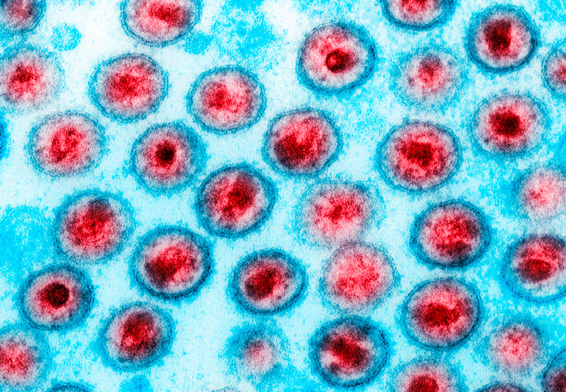 Ruhende infizierte T-Helferzellen bilden ein Reservoir für HIV im Körper, das sich der Immunantwort entzieht. / Foto: Getty Images/Callista Images