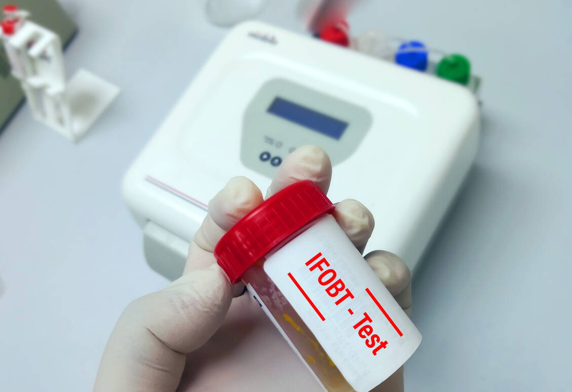 Heute Standard zum Nachweis von okkultem Blut: der immunologische Stuhltest (iFOBT) / © Shutterstock/Babul Hosen