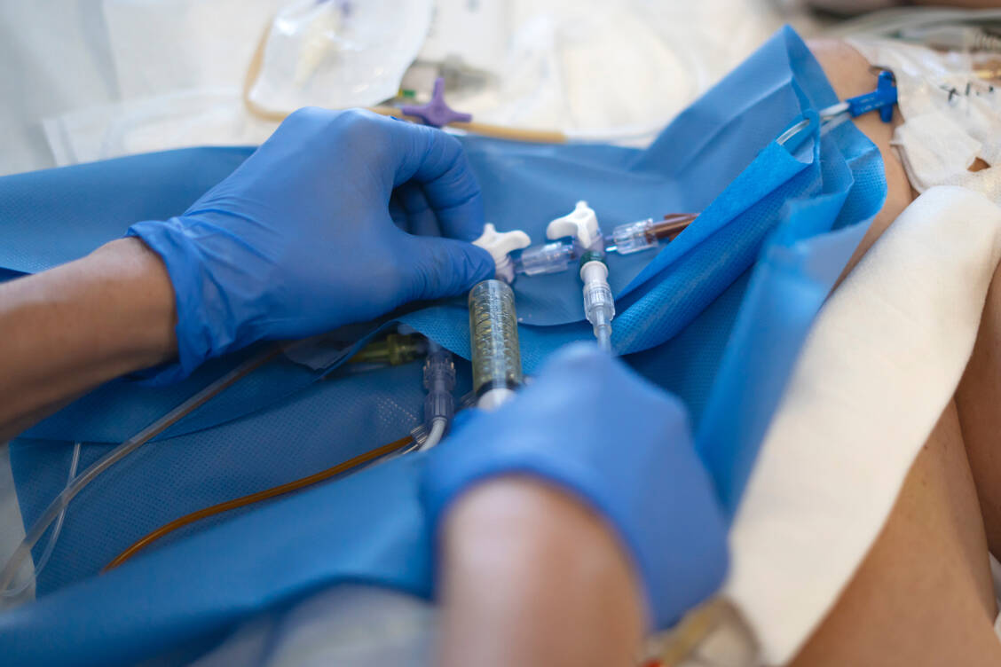 Auf der Intensivstation kann es bei der simultanen intravenösen Applikation mehrerer Arzneimittel über das gleiche Katheterlumen zu Inkompatibilitäten kommen. Kompatibilitätslisten können das Risiko dafür verringern. / © Adobe Stock/Carmen