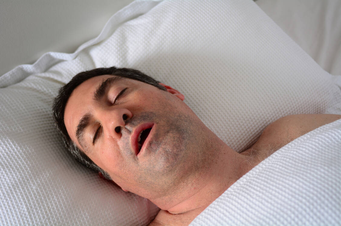 Viele Patienten mit obstruktiver Schlafapnoe sind übergewichtig und schnarchen laut. Eine Überdruckbeatmung kann helfen, wird aber aufgrund der sperrigen Maske oft nicht toleriert. / Foto: Adobe Stock/Rafael Ben-Ari
