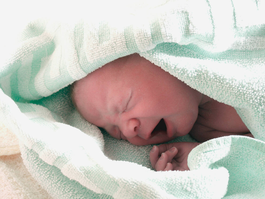 In Gelsenkirchen wurden drei Kinder mit Anomalien der Hand geboren. Eine Häufung kann das zuständige Gesundheitsministerium nicht erkennen. / Foto: Fotolia/Hampel