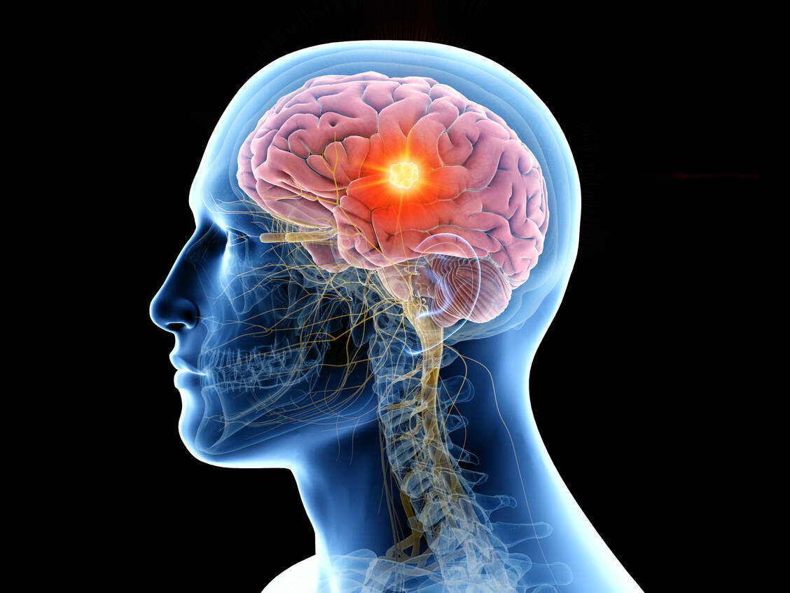 Viele Untersuchungen zeigen, dass Coronaviren auch in das zentrale Nervensystem beziehungsweise das Gehirn eindringen können. / Foto: Adobe Stock/SciePro