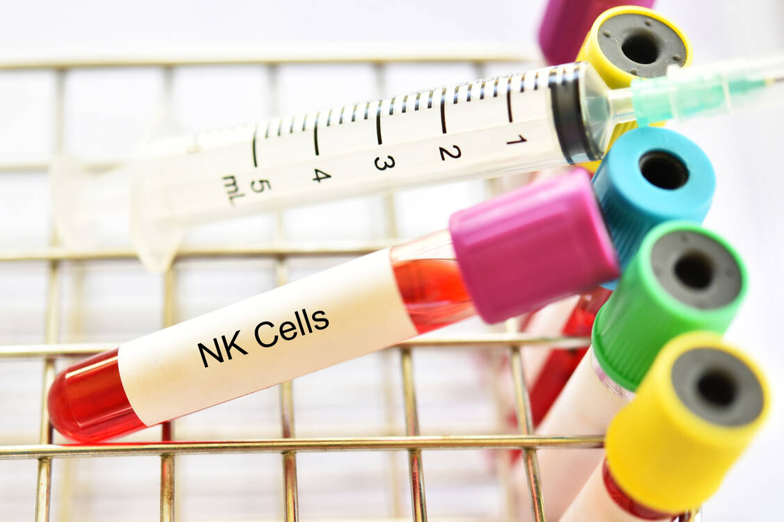 Bei einigen Covid-19-Patienten reagiert das Immunsystem  so stark auf SARS-CoV-2, dass der Körper gegenreguliert und den dämpfenden Botenstoff TGFβ bildet. Das blockiert unter anderem die Funktionsfähigkeit der NK-Zellen. Zu dem Zeitpunkt ist das Coronavirus jedoch noch nicht beseitigt, das hemmende Signal kommt damit zu früh.  / Foto: Adobe Stock/jarun011