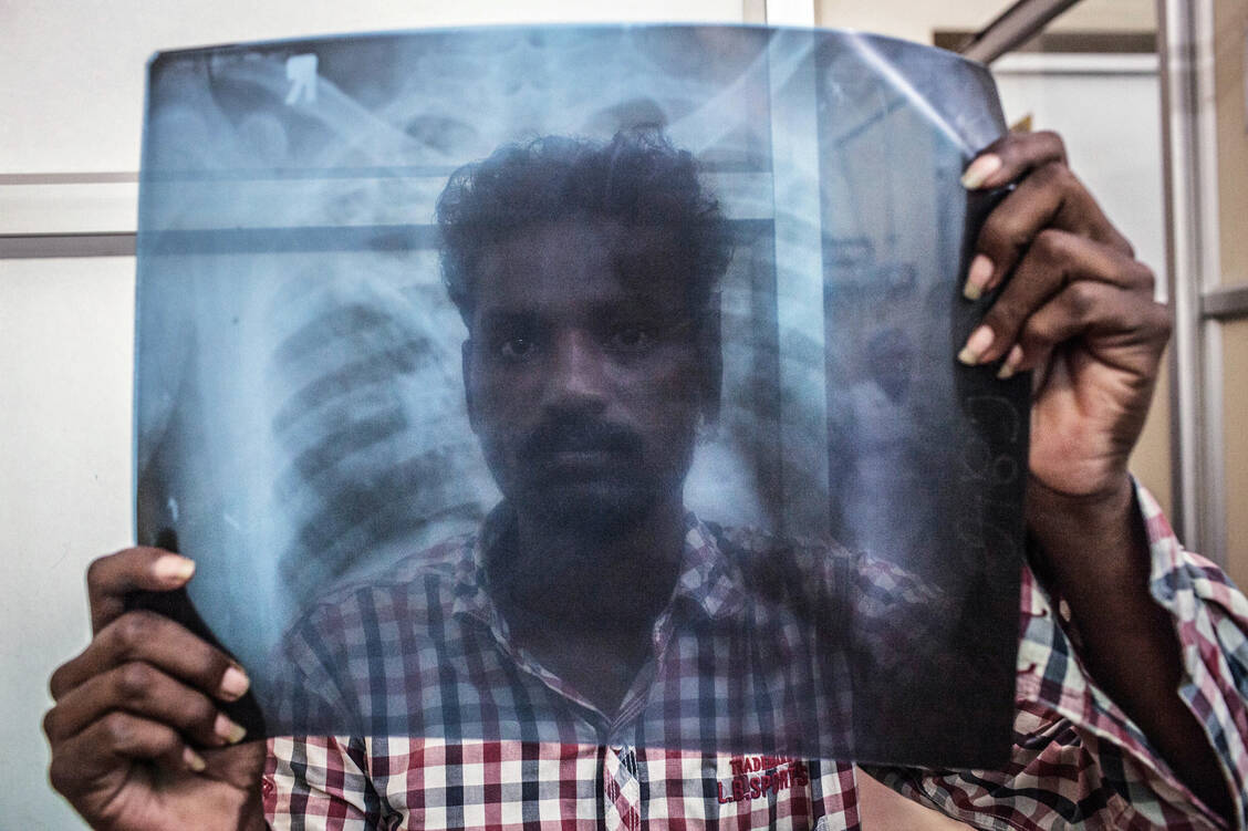 Mehr als 1,5 Millionen Menschen weltweit sterben jedes Jahr an Tuberkulose. In Indien treten die meisten Fälle auf. / Foto: dpa