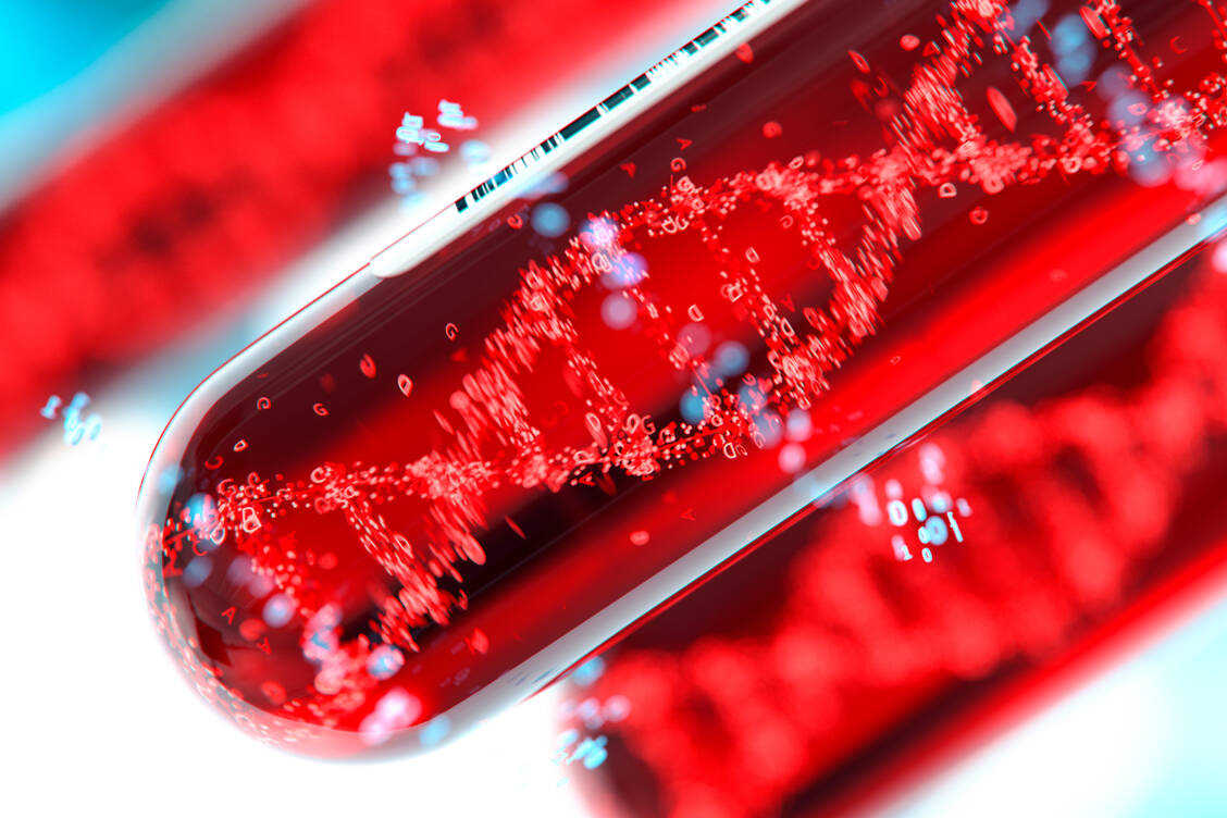 Die Gentherapie mit Valoctocogen roxaparvovec soll bei Patienten mit Hämophilie A die regelmäßigen Faktor-VIII-Infusionen zumindest vorübergehend überflüssig machen. / Foto: Adobe Stock/Connect world
