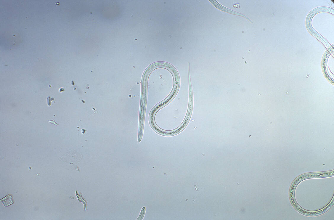 So sieht er aus, der Zwergfadenwurm. Wahrscheinlich ist er der Grund dafür, dass die Wirksamkeit von Ivermectin gegen Covid-19 teilweise stark überschätzt wurde. / Foto: CDC/Dr. Mae Melvin