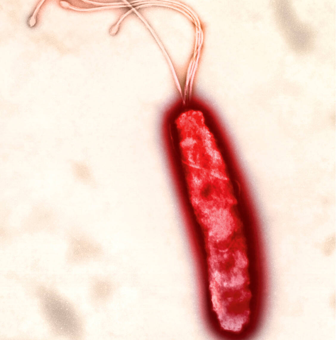Vorreiter bei den onkogenen Bakterien: ­Helicobacter pylori / Foto: Your Photo Today