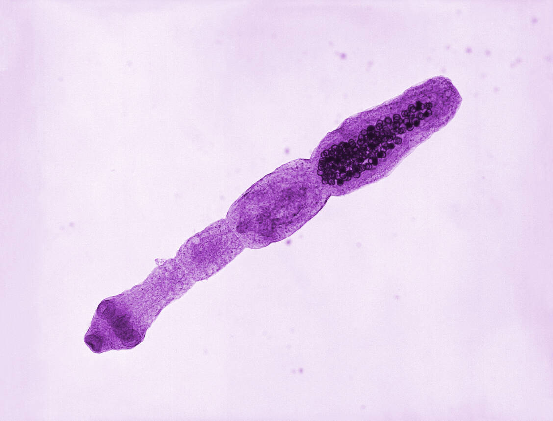 Der adulte Fuchsbandwurm ist wenige Millimeter groß. In seinem letztem Körperabschnitt (Proglottis) reifen hunderte Eier heran. / © CDC/Dr. Healy