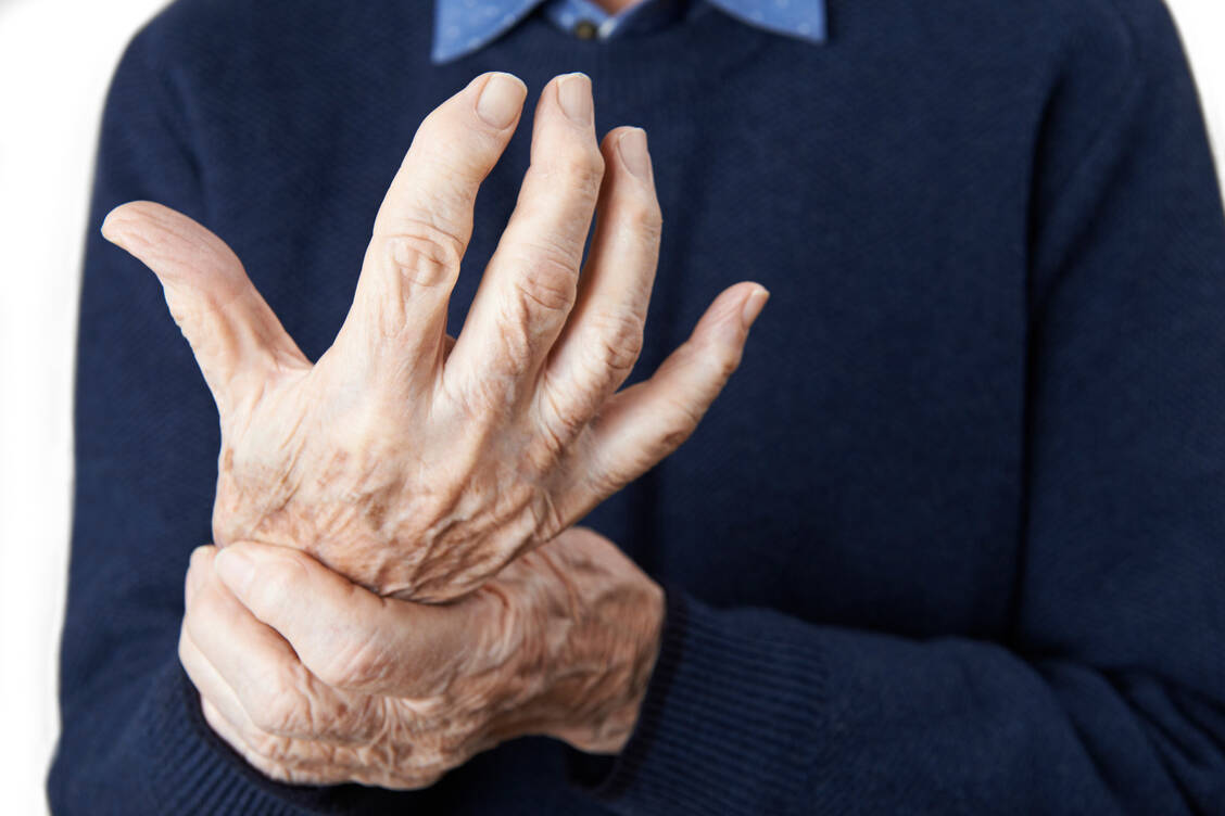 Wie wirkt sich eine entzündlich-rheumatische Vorerkrankung auf den Verlauf einer SARS-CoV-2-Infektion aus? Dazu gibt es bislang keine belastbaren Daten. / Foto: ©highwaystarz - stock.adobe.com