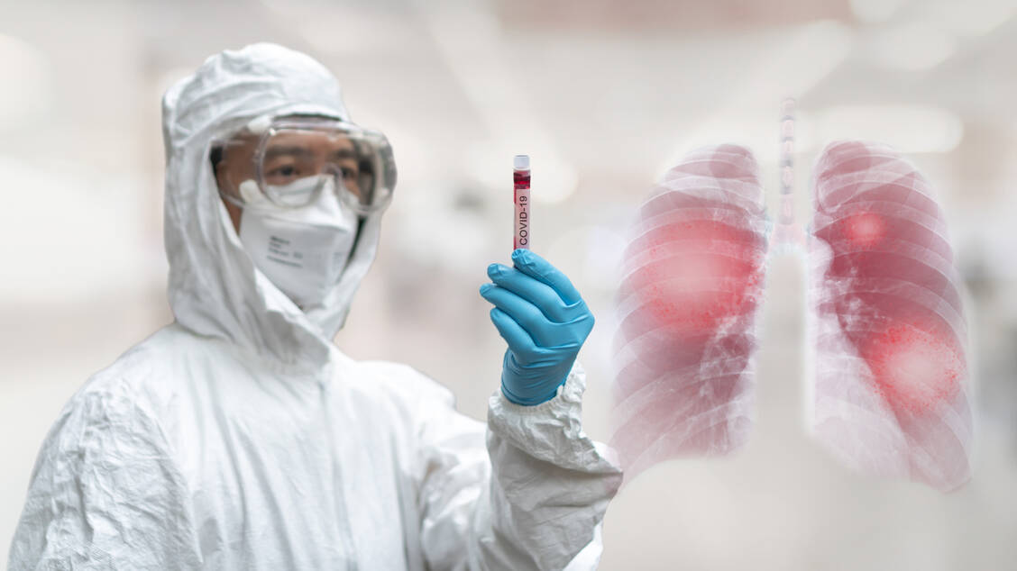 Bei schwer erkrankten Covid-19 Patienten fanden Wissenschaftler zahlreiche Thrombosen in kleinen Lungengefäßen. Daraus kann sich eine systemische Thromboseneigung entwickeln. / Foto: Adobe Stock/Chinnapong