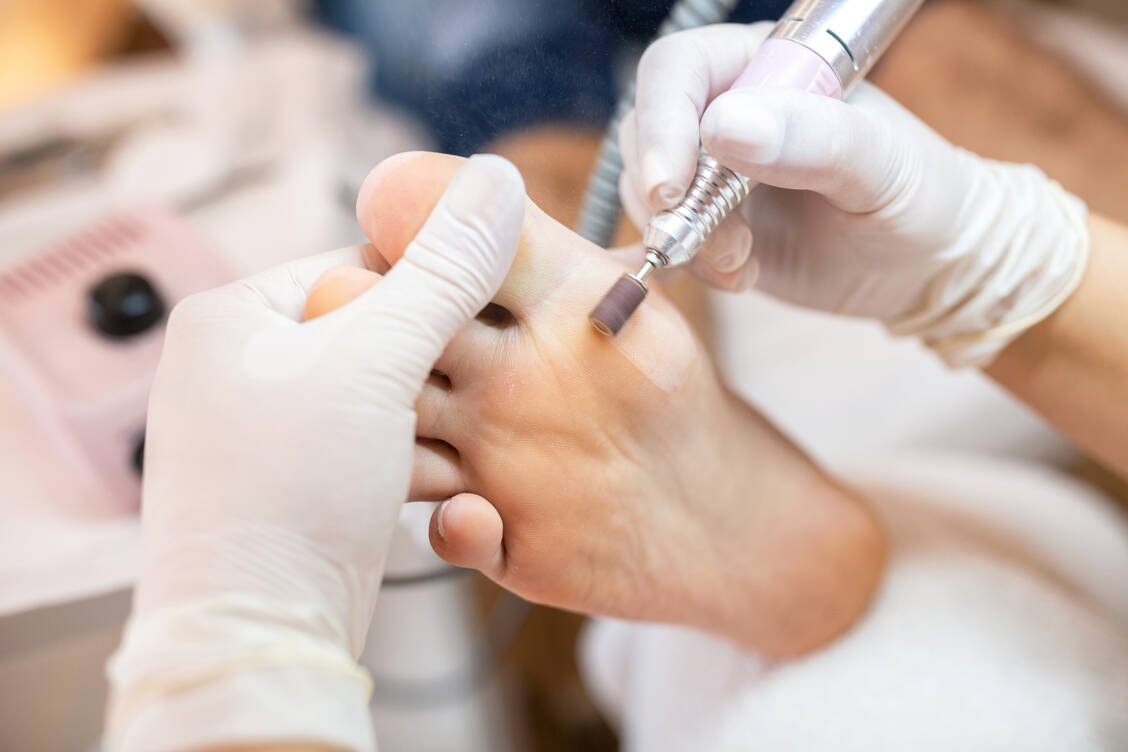 Alle Diabetiker sollten regelmäßig zur Fußpflege beziehungsweise selbst ihre Füße kontrollieren. Unter SGLT-2-Hemmern gilt das ganz besonders. / Foto: Adobe Stock/didesign