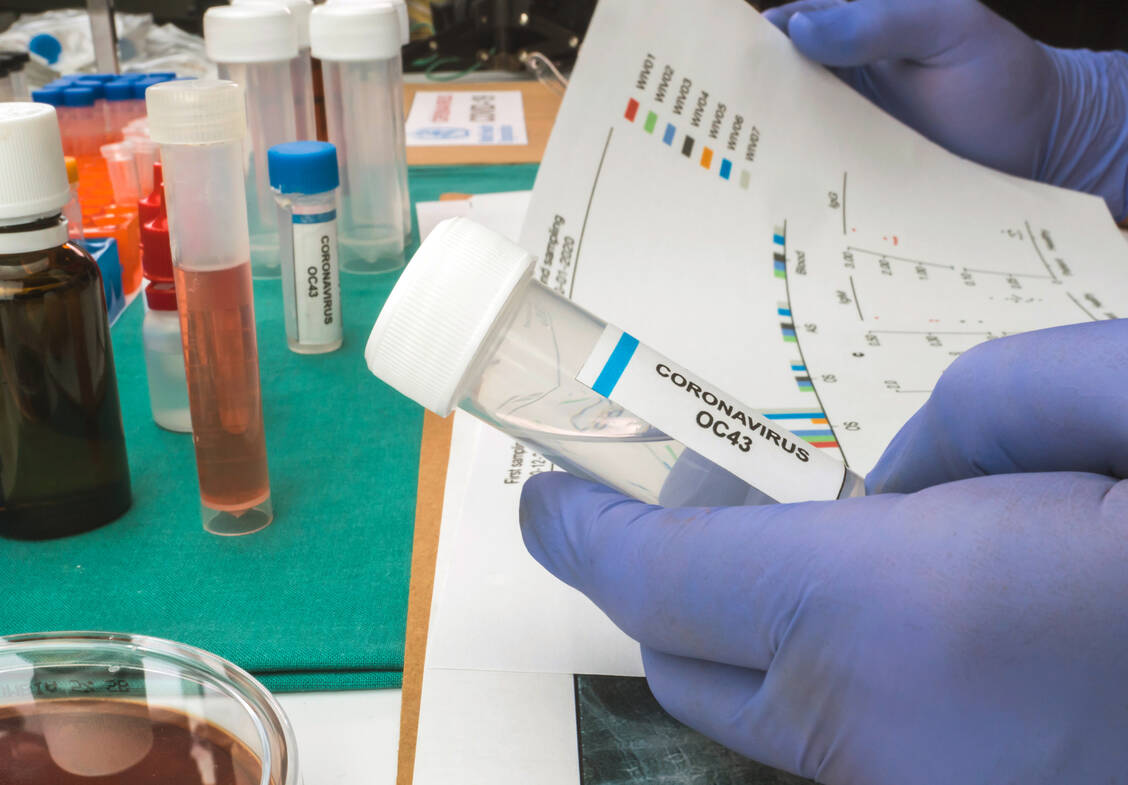 Laut der Universität Münster treten nach einer früheren Infektion mit dem saisonalen Coronavirus OC43 schwere Krankheitsverläufe bei Covid-19 seltener auf. Die Hypothese für diese Schutzwirkung entstand aus den Daten von genesenen Covid-19-Patienten, die im Frühjahr 2020 einem Aufruf des Universitätsklinikums Münster für eine Coronaplasma-Studie gefolgt waren. / Foto: Adobe Stock/felipecaparros