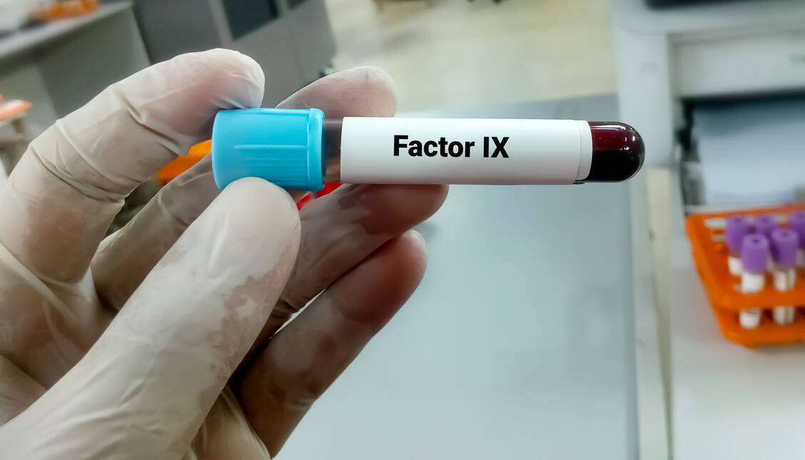 Bei der Erbkrankheit Hämophilie B liegt ein angeborener Mangel des Faktors IX vor. Erstmals gibt es für die Betroffenen einen kausalen Behandlungsansatz. / Foto: Getty Images/Md Saiful Islam Khan
