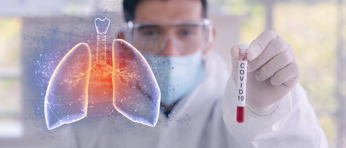 Das Virus SARS-CoV-2 verändert den Stoffwechsel in der Lunge, was zu einer starken Fettansammlung in dem Organ führt. / Foto: Adobe Stock/akesin@gmail.com