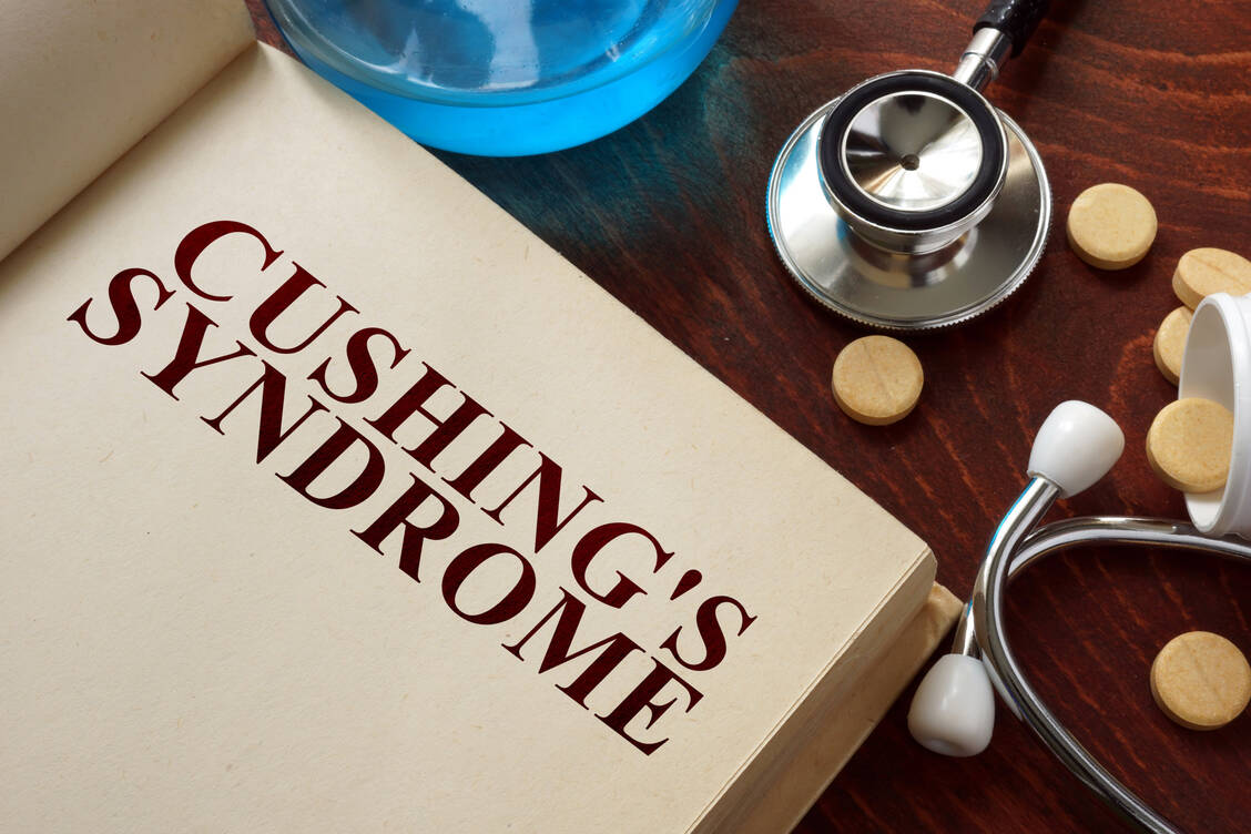 Das Cushing-Syndrom ist nach dem US-amerikanischen Gehirnchirurgen Dr. Harvey Cushing benannt. Der Arzt hatte es im Jahr 1910 erstmals beschrieben. / Foto: Adobe Stock/Vitalii Vodolazskyi