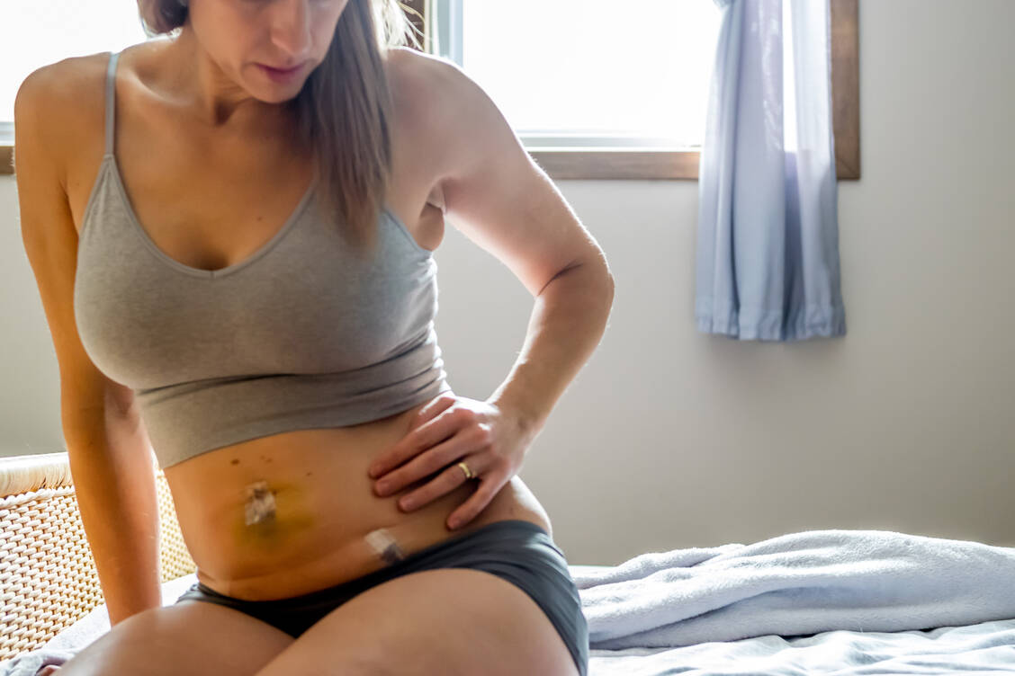 Eine Laparoskopie kommt beispielsweise bei Verdacht auf Endometriose zum Einsatz. / Foto: Getty Images/A&J Fotos