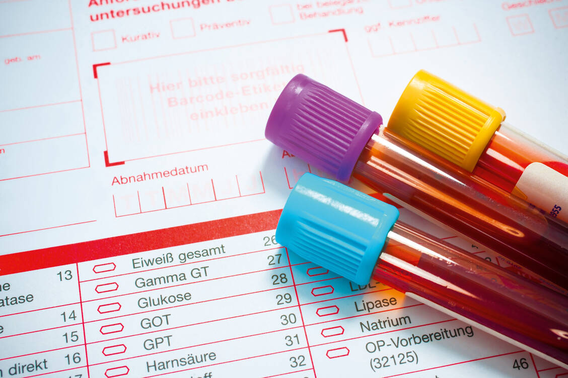 Unter einer MS-Therapie müssen je nach Präparat regelmäßig Leberwerte und Lymphozytenzahlen kontrolliert werden. / Foto: Fotolia/Alexander Raths
