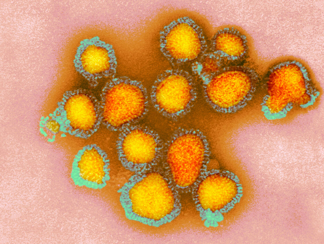 Influenzaviren besitzen in ihrer Hülle als wichtige Oberflächenprotein das Hämagglutinin.  / Foto: Getty Images/Cdc/Science Photo Library