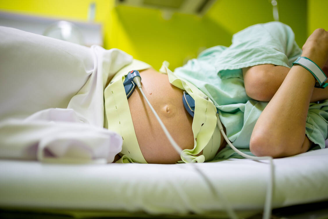 Wird eine Geburt medikamentös eingeleitet, werden Wehentätigkeit und Herztöne des Babys kontinuierlich überwacht. / Foto: Adobe Stock/Gaj Rudolf