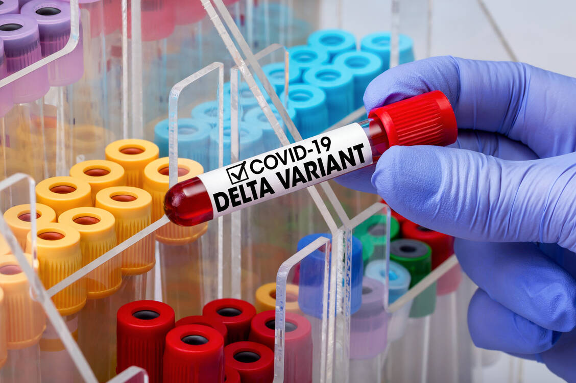 Für die Erfassung der Virusvarianten werden keine Blutproben analysiert, sondern die Mund-Rachen-Abstriche der PCR-Tests; allerdings wird nur ein Teil aller positiven Proben sequenziert. / Foto: Adobe Stock/angellodeco