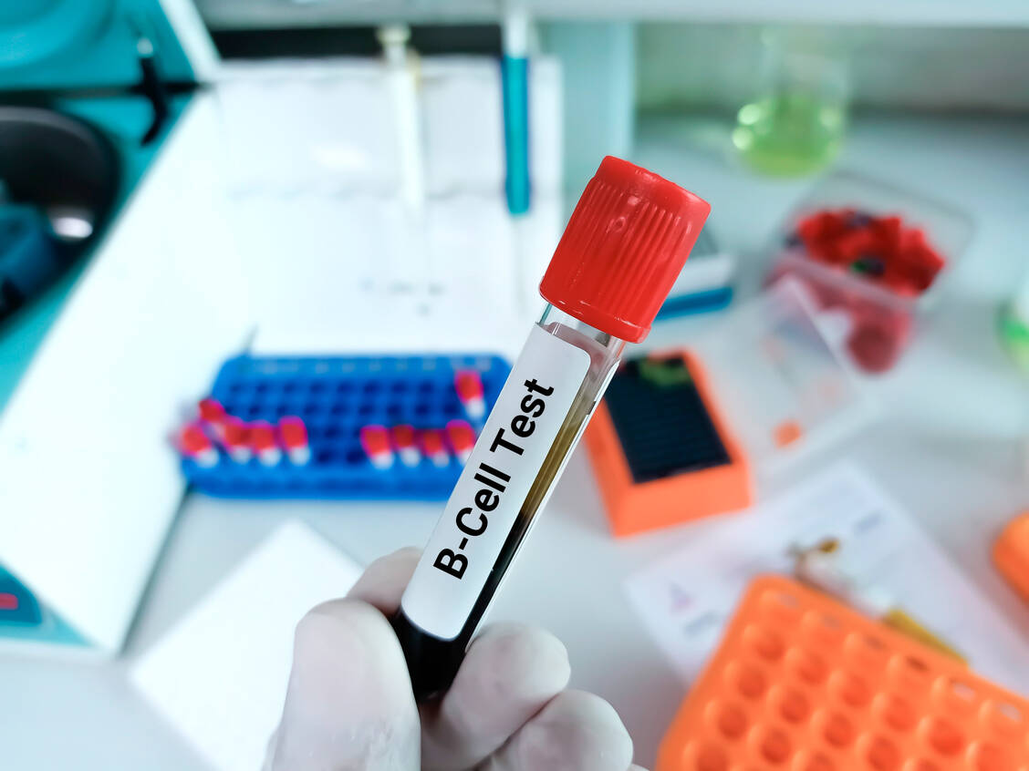 Eine umfangreiche Labordiagnostik ist nötig, bevor die Herstellung der gentechnisch modifizierten T-Zellen beginnen kann. / Foto: Adobe Stock/Innovative Creation