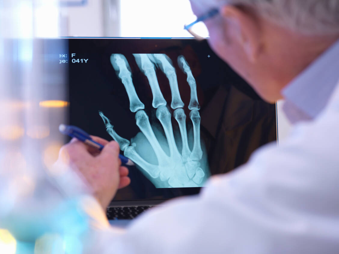 Mithilfe der Röntgenstrahlen konnten anfangs nur die knöchernen Strukturen des Körpers dargestellt werden. Mittlerweile können geschulte Ärzte sehr viel aus einer guten Aufnahme herauslesen. / Foto: Getty Images/Andrew Brookes
