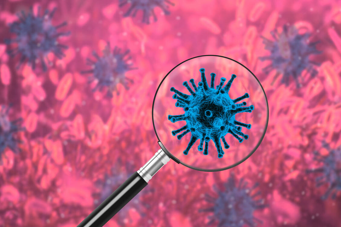 In Deutschland wird nur bei einem kleinen Teil der positiven PCR-Proben genauer untersucht, welche Variante von SARS-CoV-2 vorliegt. Daher ist das Bild der Virusvarianten ein unvollständiges. / Foto: Getty Images/Vaidas Bucys/EyeEm