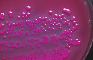 Identifiziert: Escherichia coli auf der Agarplatte und unter dem Rasterelektronenmikroskop. E. coli ist in rund 80 Prozent der Fälle der Auslöser unkomplizierter Harnwegsinfektionen.
<p class="fotonachweis">Foto links: Dr. Gero Beckmann, Institut Romeis Bad Kissingen GmbH; Foto rechts: Jürgen Berger, MPI für Entwicklungsbiologie</p>