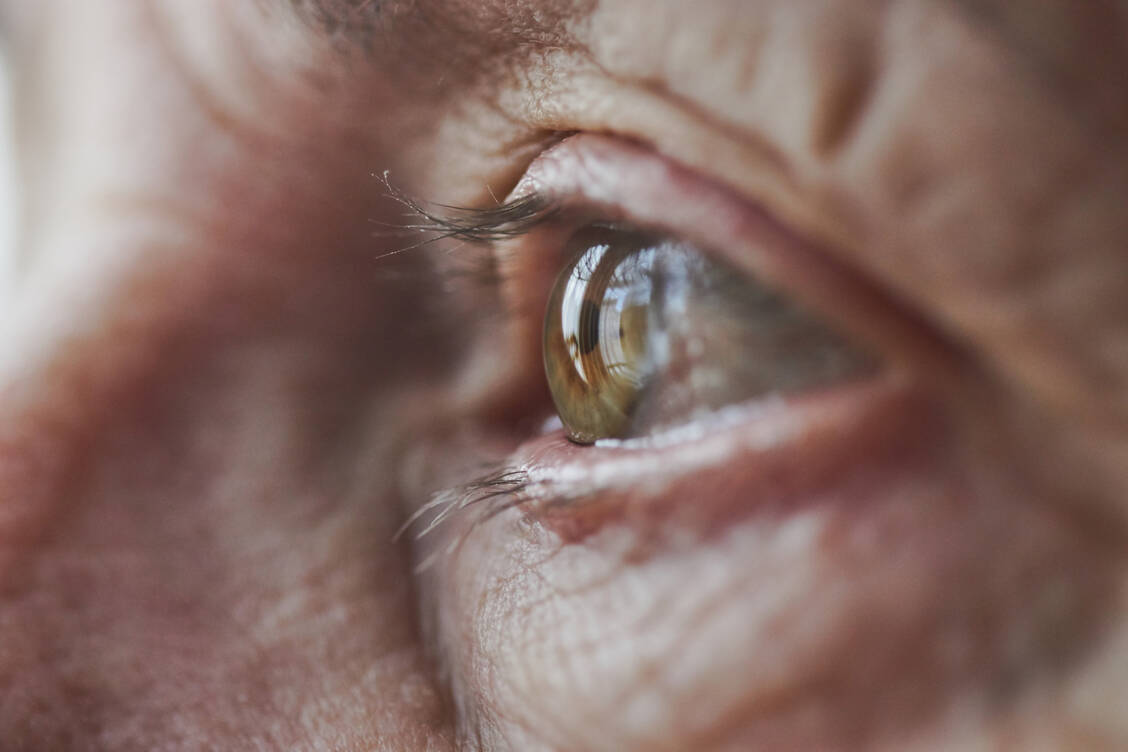 Circa 2 Prozent aller Menschen ab 40 Jahren haben ein Offenwinkelglaukom. Bei den Über-75-jährigen sind es 7 bis 8 Prozent. / © Getty Images/Rhys Hayward