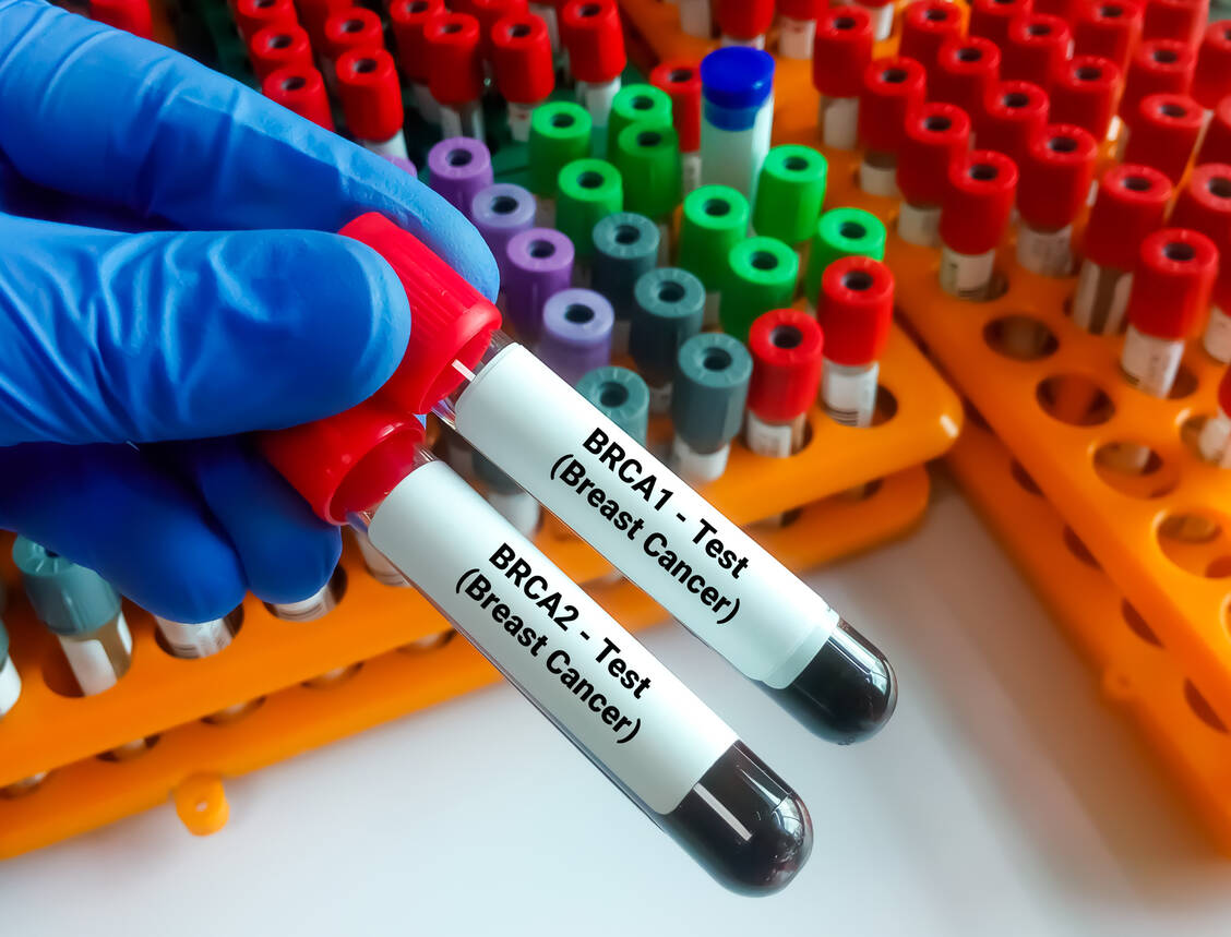 Eine Mutation in den Tumorsuppressorgenen BRCA1 und BRCA2 geht mit einem erhöhten Risiko für Brust- und Eierstockkrebs einher.  / Foto: Adobe Stock/Saiful52
