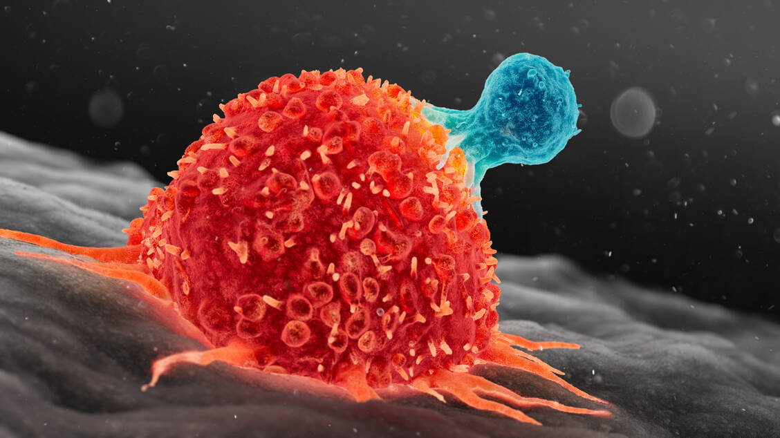 Wir brauchen die T-Zellen unseres Immunsystems, um Krebszellen zu attackieren. Es wird an Techniken gearbeitet, die Abwehrzellen scharf zu schalten. / Foto: Getty Images/Science Photo Library/Thom Leach