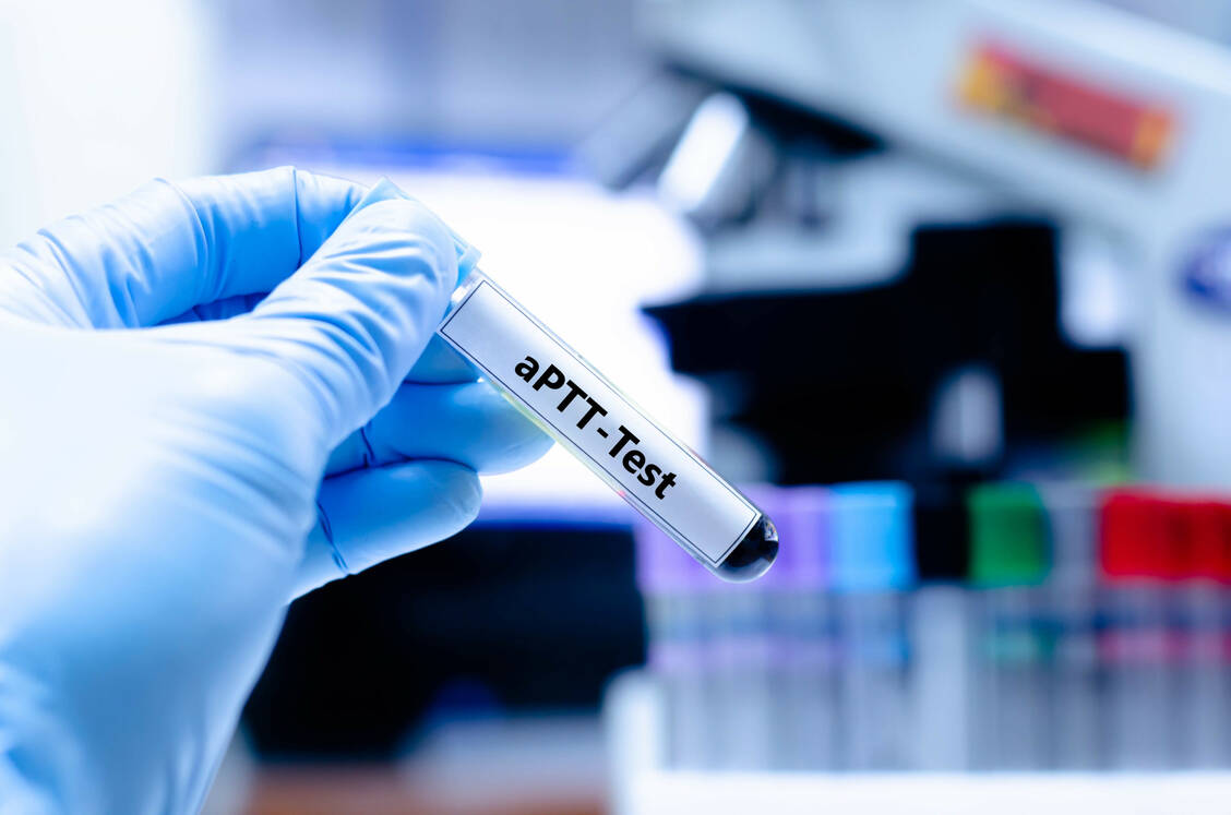 Die aktivierte partielle Thromboplastinzeit (aPTT) ist einer von vielen Basisparametern der Blutgerinnung. Die aPTT erfasst Störungen der Gerinnungsfaktoren I, II und V sowie VIII bis XII. / Foto: Adobe Stock/kitsawet