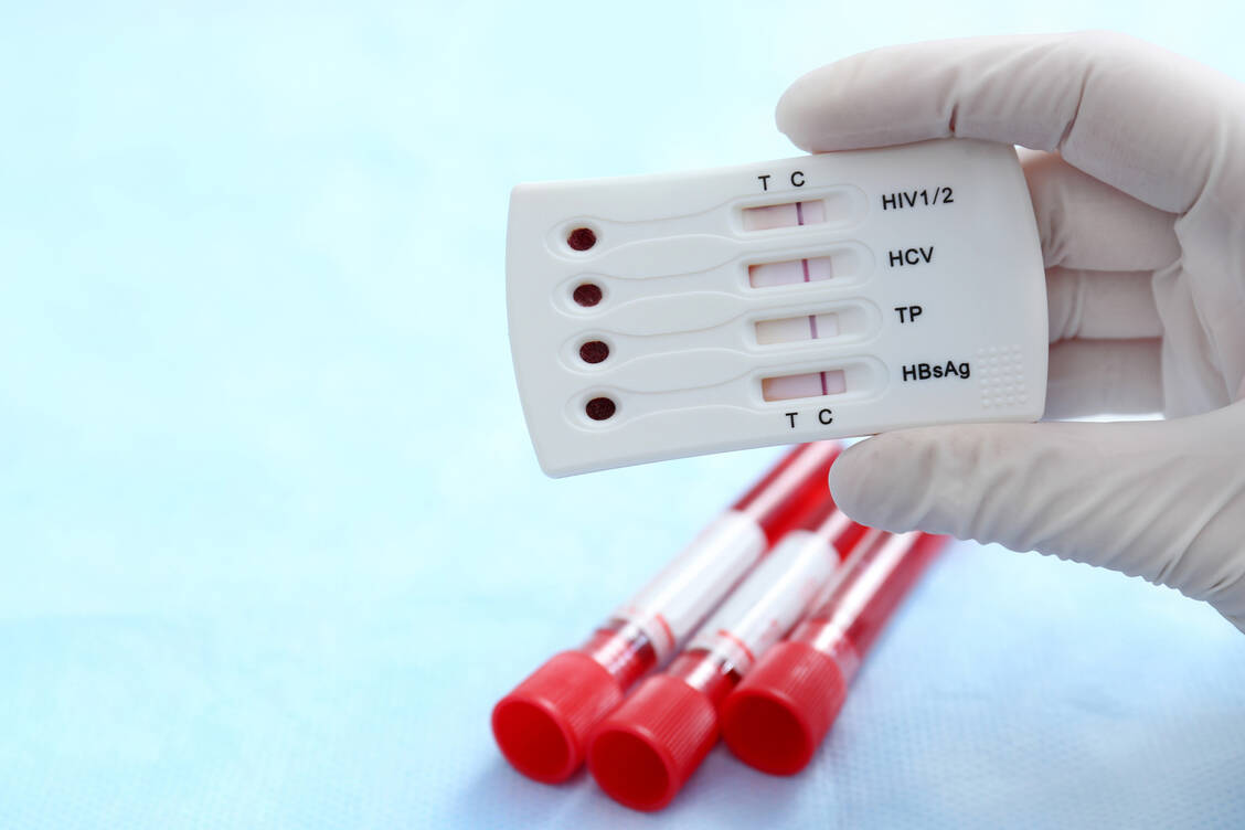 Einige Infektionskrankheiten und -erreger können das ungeborene Kind schwer schädigen. Für manche, zum Beispiel Hepatitis B und Treponema pallidum (Tp), sind Screening-Untersuchungen in der Schwangerschaft vorgesehen. / Foto: Adobe Stock/Africa Studio