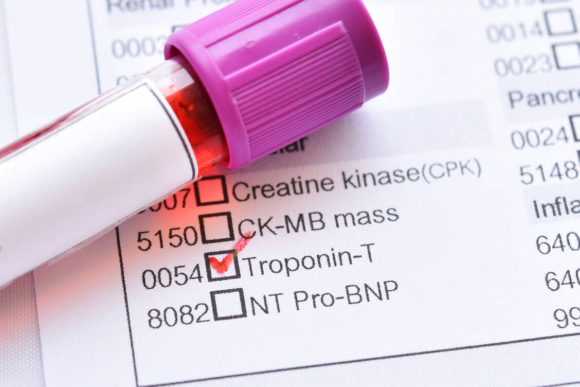 Der Troponintest ist Teil der Labordiagnostik, wenn Verdacht auf einen Herzinfarkt besteht. Bei Schwangeren könnten erhöhte Troponin-Blutspiegel zudem ein erhöhtes Präeklampsie-Risiko anzeigen.  / Foto: Adobe Stock/jarun011