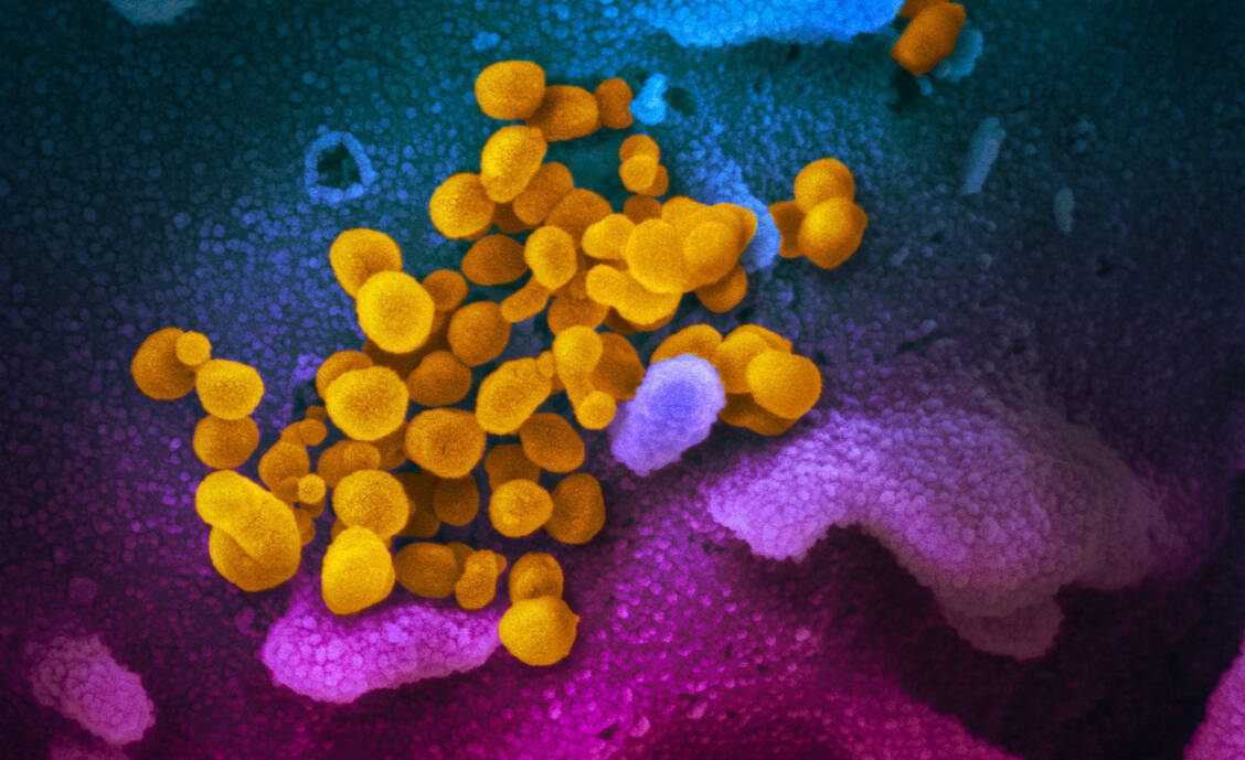 Das Coronavirus SARS-CoV-2 gehört einer aktuellen Untersuchung zufolge offenbar nicht zu den Erregern, die ein Guillain-Barré-Syndrom auslösen können. / Foto: NIH