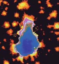Thrombus im Fluoreszenzmikroskop
<p class="fotonachweis">Foto: Roche</p>