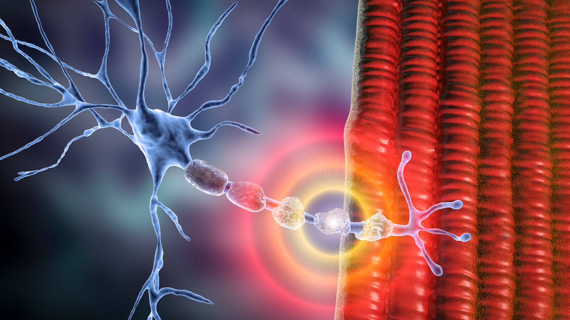 Bei Multipler Sklerose kommt es zu einem Abbau der isolierenden Myelinschicht am Axon. Die eigenen Immunzellen greifen dort an. / Foto: Getty Images/Science Photo Library/Kateryna Kon