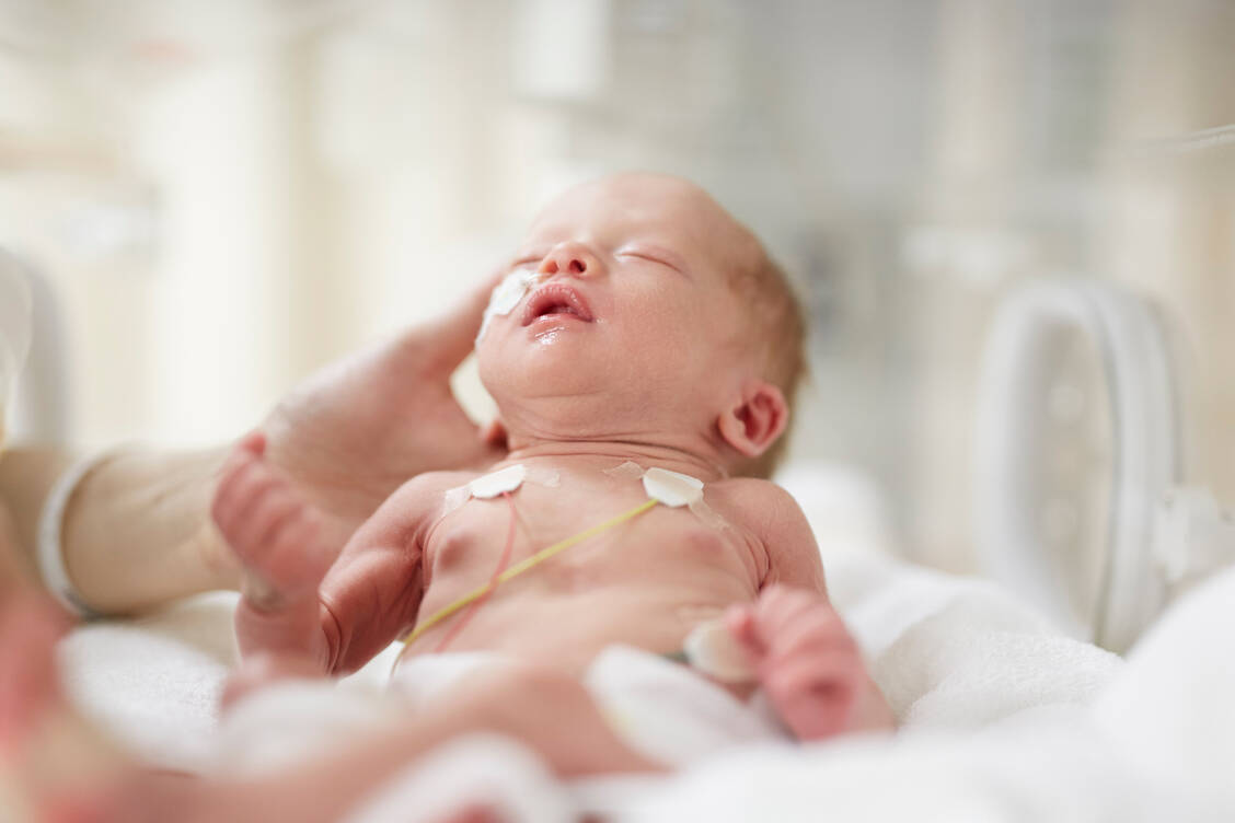 Zu früh geborenen Kindern können Viren, mit denen die meisten reif geborenen Babys klar kommen, gefährlich werden. / Foto: Getty Images/arrow