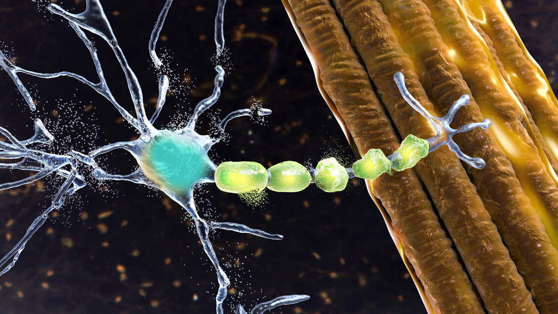 Bei der amyotrophen Lateralsklerose sammelt sich das Protein TDP-43 im Zellplasma von Motorneuronen an und führt zu deren Absterben. / © Getty Images/Science Photo Library
