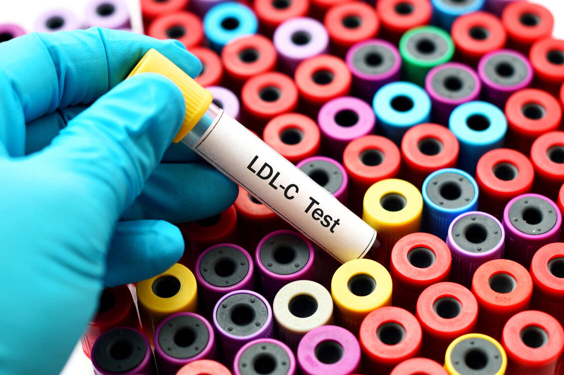 Menschen mit homozygoter familiärer Hypercholesterolämie, einer erblich bedingten Störung des Fettstoffwechsels, weisen extrem hohe LDL-Cholesterol-Werte auf und sprechen auf herkömmliche Therapeutika zur LDL-Senkung nicht gut an.  / Foto: Adobe Stock/jarun011
