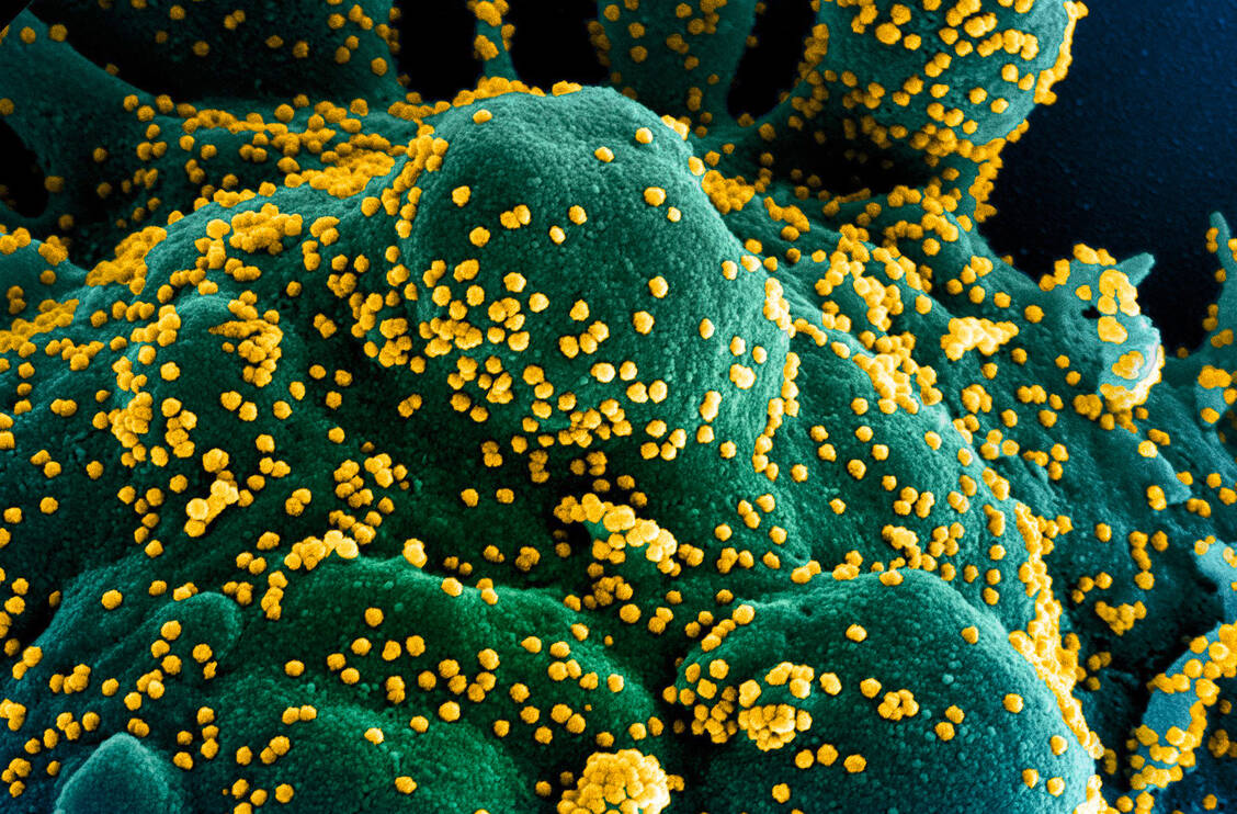 Ist das Immunsystem eines Patienten nicht in der Lage, SARS-CoV-2 in Schach zu halten, hat das Virus mehr Möglichkeiten zu mutieren als bei immunkompetenten Personen. / Foto: NIAID