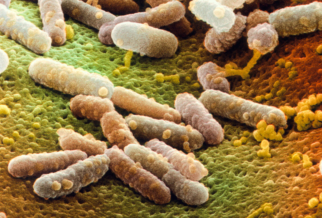Bestimmte Bakterienarten, darunter Escherichia coli, könnten nach gentechnischer Manipulation womöglich dazu genutzt werden, solide Tumore für einen Angriff durch CAR-T-Zellen zu markieren. / Foto: Science Photo Library/Power And Syred