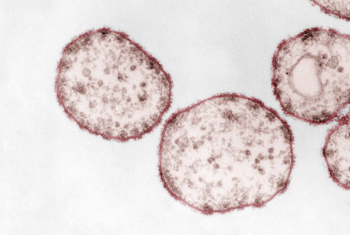 Auch das Masernvirus kommt offenbar als Vektor für Impfstoffe gegen SARS-CoV-2 infrage. / Foto: Hans R. Gelderblom, Freya Kaulbars. Kolorierung: Andrea Schnartendorff/RKI