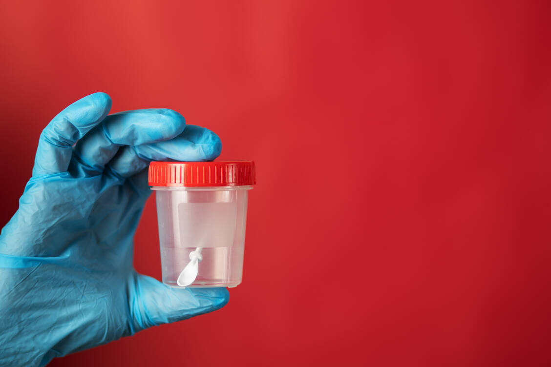 Bei Mikrobiomtests wird in der Stuhlprobe vorhandenes Erbgut ausgewertet, um Arten und Häufigkeiten von Bakterien und anderen Lebewesen im Darm zu ermitteln. / Foto: Getty Images / Yana Tikhonova