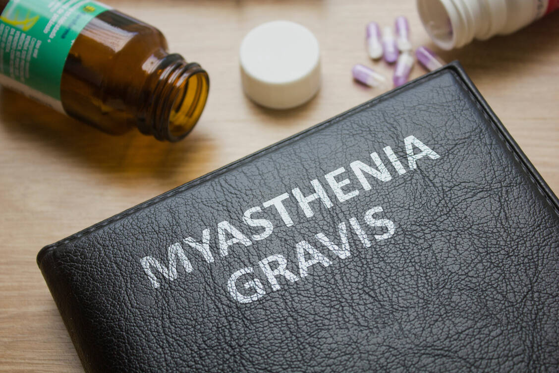 Myasthenia gravis ist eine seltene Autoimmunerkrankung, bei der die Signalübertragung zwischen Nerv und Muskel gestört ist. / Foto: Adobe Stock/mdaros