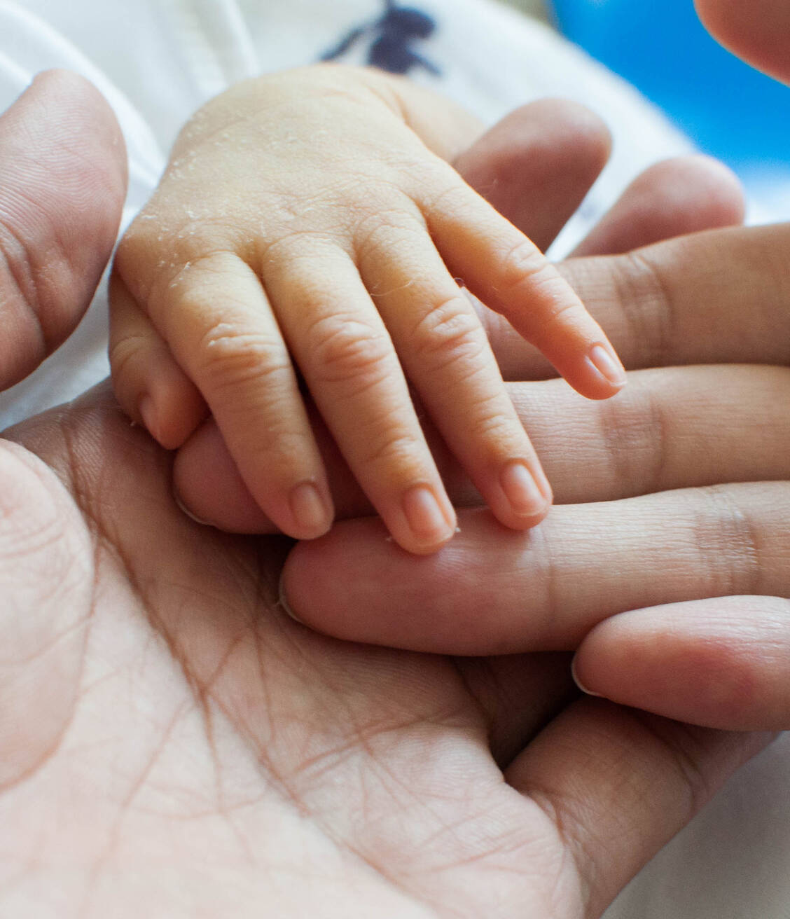 Ein mögliches frühes Anzeichen für das Alagille-Syndrom ist es, wenn die Neugeborenen-Gelbsucht ungewöhnlich lange anhält. / Foto: Getty Images/Karl Tapales