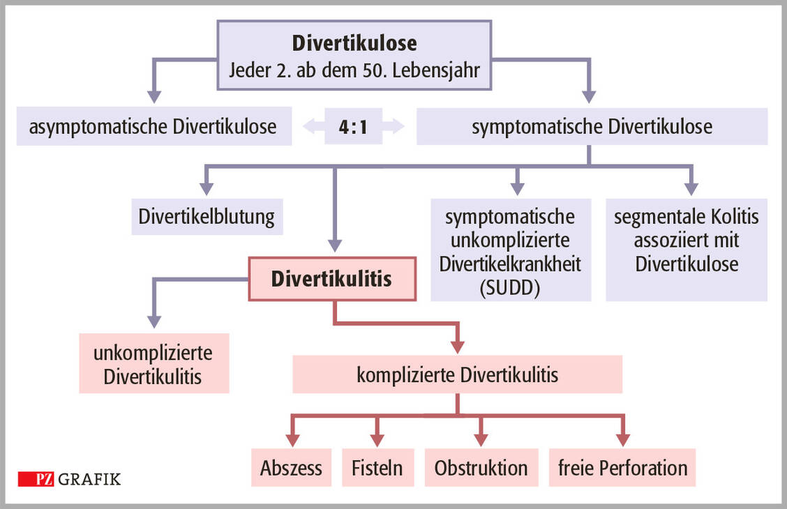 Grafik 1: Klinisches Spektrum der Divertikelkrankheit; mod. nach (5) / Foto: PZ/Stephan Spitzer