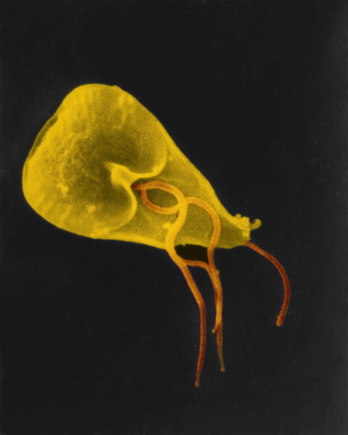 Infektionen mit dem Parasiten Giardia lamblia können zu einem Reizdarmsyndrom führen.  / © Getty Images/Scott Camazine