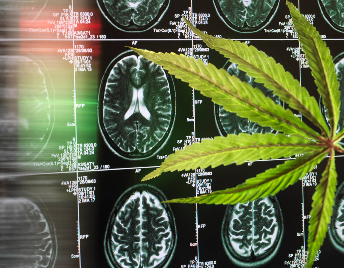 Cannabis stört die Hirnchemie. Besonders vulnerabel sind Heranwachsende, da sich das Gehirn während der Pubertät in einer Umbauphase befindet. / Foto: Getty Images/Andrew Brookes